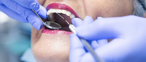 Best Emergency Cosmetic Dentistry (e.g., broken veneers) in Harristown, IL